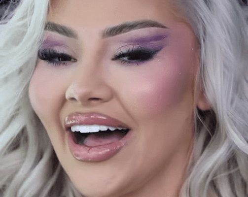 “Dhëmbët që pushtuan botën” – Benita Zena rikthehet te klinika që e bëri virale